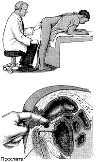 Проверка предстательной железы